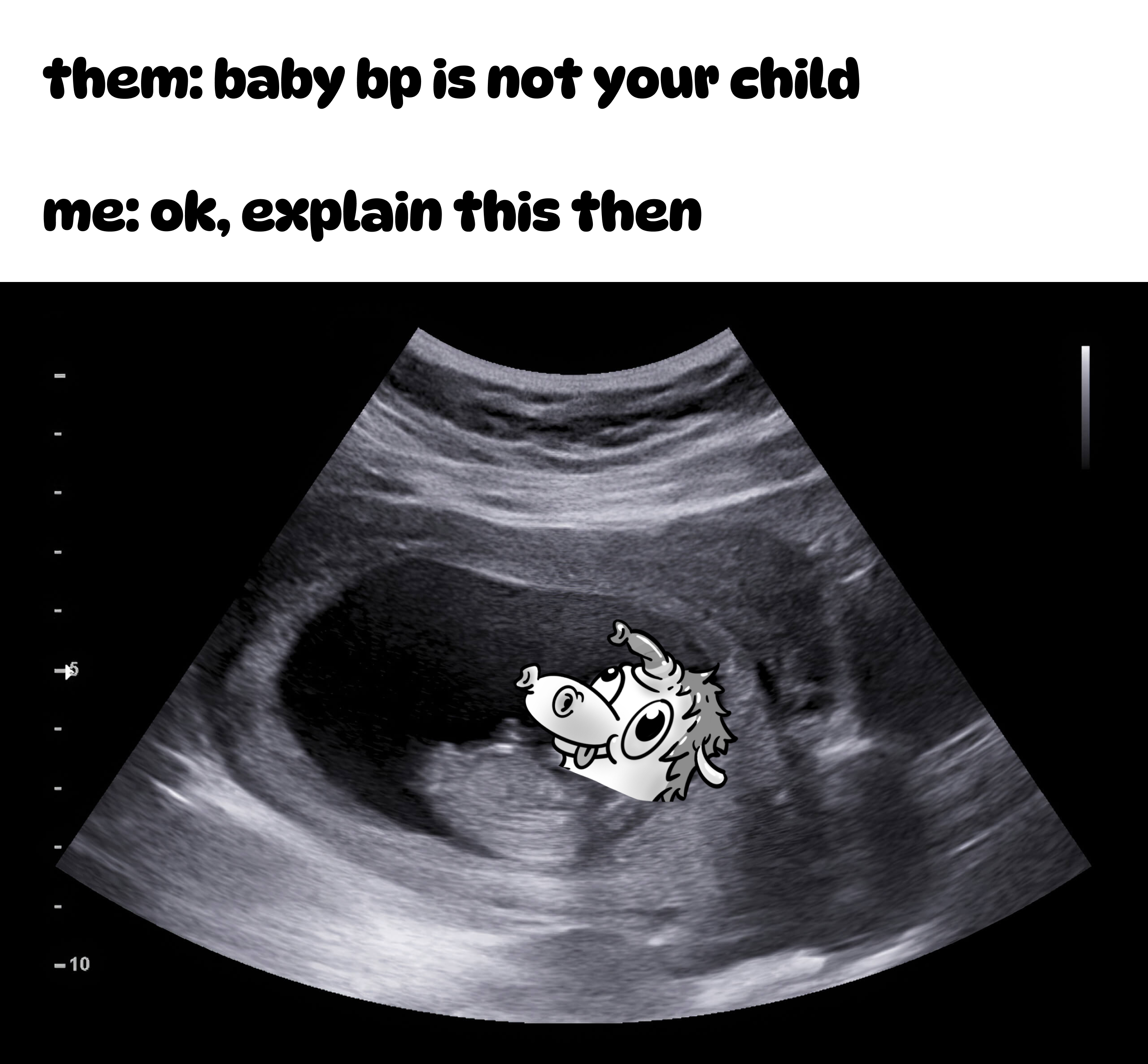 baby bp is my child